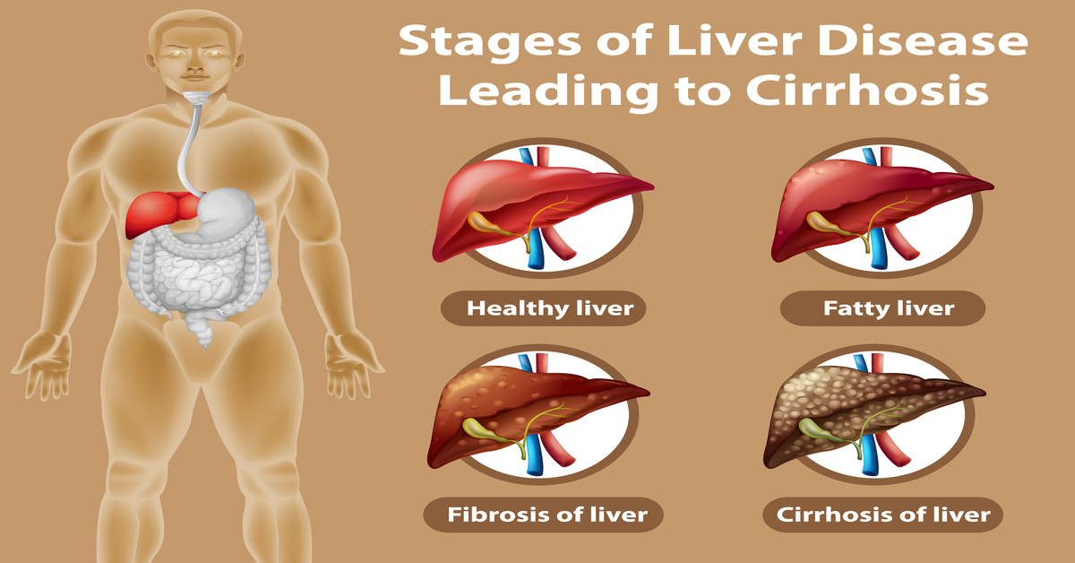 death-risk-from-liver-disease-twice-as-high-in-lower-income-countries